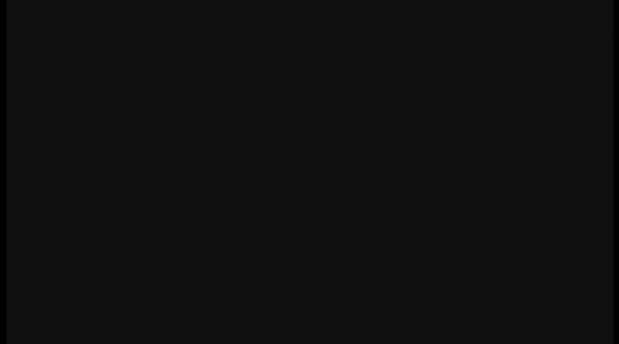 經(jīng)皮腎鏡手術治療及STORZ經(jīng)皮腎鏡 26092AMA維修案例分析